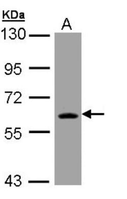 Thioredoxin Reductase 1/TRXR1 Antibody, Novus Biologicals 0.1mL; Unlabeled:Antibodies,