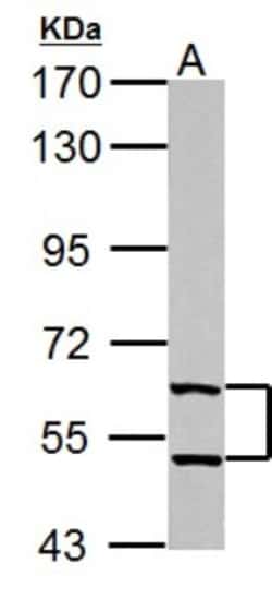 Thioredoxin Reductase 1/TRXR1 Antibody, Novus Biologicals 0.1mL; Unlabeled:Antibodies,