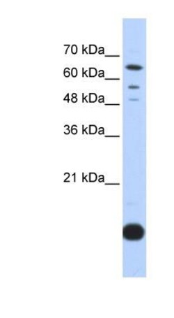 Thioredoxin-2 Antibody, Novus Biologicals:Antibodies:Primary Antibodies