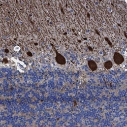 Thioredoxin-like 5/TRP14/TXNDC17 Antibody, Novus Biologicals 25 &mu;L;