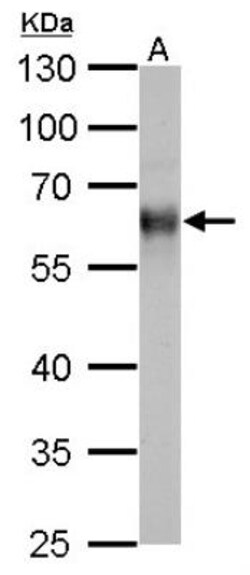 Thioredoxin Reductase 1/TRXR1 Antibody, Novus Biologicals 0.1mL; Unlabeled:Antibodies