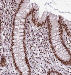 THOC2 Antibody, Novus Biologicals 25 &mu;L, Unlabeled:Antibodies, Polyclonal