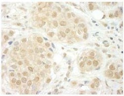 THOC5 Antibody, Novus Biologicals 0.1mL; Unlabeled:Antibodies, Polyclonal
