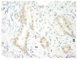 THOC5 Antibody, Novus Biologicals 0.1mL; Unlabeled:Antibodies, Polyclonal