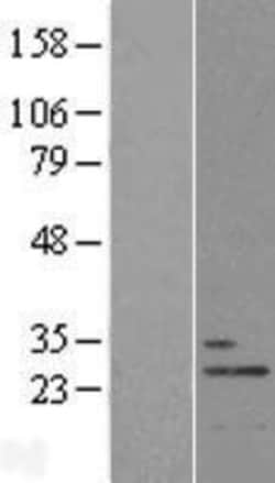 Novus Biologicals&trade;&nbsp;THOC7 Overexpression Lysate