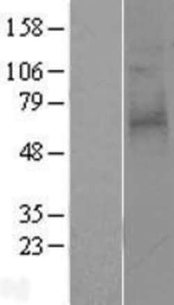 Novus Biologicals&trade;&nbsp;PAR3/Thrombin Receptor-like 2 Overexpression Lysate