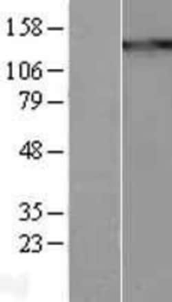 Novus Biologicals™ Thrombospondin-1 Overexpression Lysate