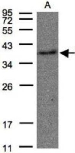 Thromboxane A2 R/TBXA2R Antibody, Novus Biologicals 0.1mL; Unlabeled:Antibodies,