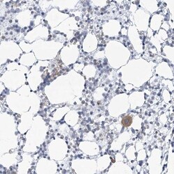 Thromboxane synthase Antibody, Novus Biologicals 25 &mu;L, Unlabeled:Antibodies,