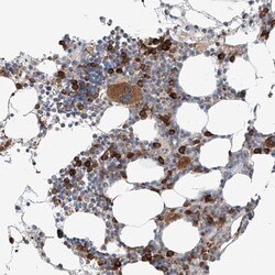 Thromboxane synthase Antibody, Novus Biologicals:Antibodies:Primary Antibodies