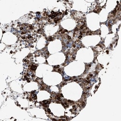Thromboxane synthase Antibody, Novus Biologicals:Antibodies:Primary Antibodies