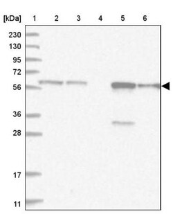 Thromboxane synthase Antibody, Novus Biologicals:Antibodies:Primary Antibodies