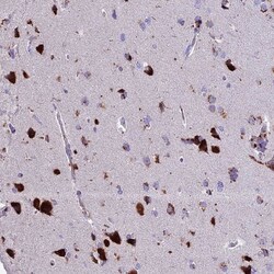 THRSP Antibody, Novus Biologicals:Antibodies:Primary Antibodies