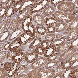 THSD7B Antibody, Novus Biologicals 0.1mL; Unlabeled:Antibodies, Polyclonal