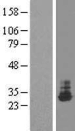 Novus Biologicals™ THTPA Overexpression Lysate