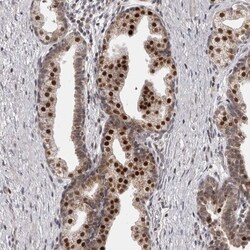THUMPD1 Antibody, Novus Biologicals 25 &mu;L | Buy Online | Novus Biologicals | Fisher Scientific
