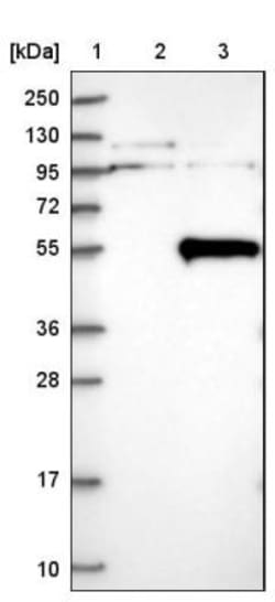 THUMPD1 Antibody, Novus Biologicals 25 &mu;L | Buy Online | Novus Biologicals | Fisher Scientific