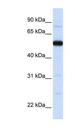THUMPD2 Antibody, Novus Biologicals 100 &mu;L | Buy Online | Novus Biologicals | Fisher Scientific