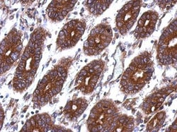 Thymidine Kinase 1 Antibody, Novus Biologicals 0.1mL; Unlabeled:Antibodies,