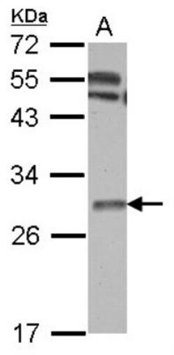 Thymidine Kinase 1 Antibody, Novus Biologicals 0.1mL; Unlabeled:Antibodies,