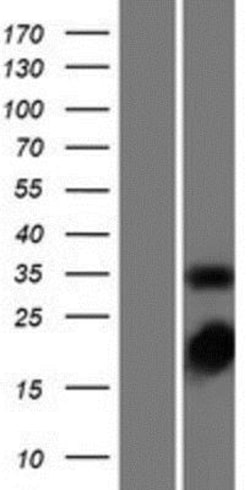 Novus Biologicals&trade;&nbsp;Thymidylate Synthase Overexpression Lysate