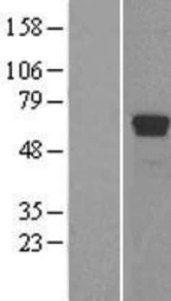 Novus Biologicals&trade;&nbsp;TDG Overexpression Lysate