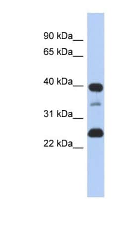 Thymopoietin/LAP2 Antibody, Novus Biologicals 100&mu;L; Unlabeled:Antibodies,