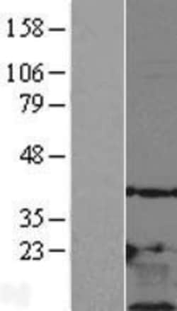 Novus Biologicals&trade;&nbsp;Thymosin beta 10 Overexpression Lysate