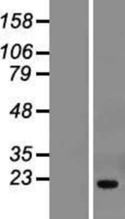 Novus Biologicals&trade;&nbsp;THYN1 Overexpression Lysate