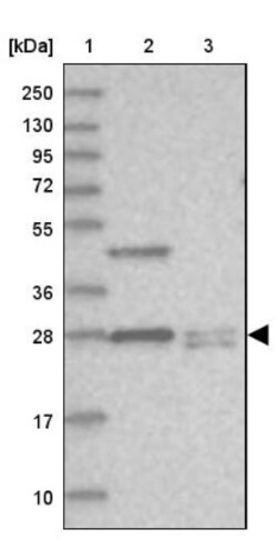 Histamine H2R Antibody, Novus Biologicals:Antibodies:Primary Antibodies