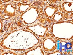 Thyroglobulin Antibody (6E1), Novus Biologicals 20 ug | Buy Online | Novus Biologicals | Fisher Scientific