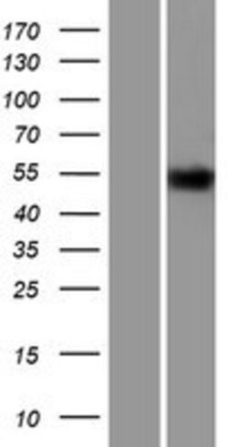 Novus Biologicals™ TR alpha/NR1A1/Thyroid Hormone Receptor alpha Overexpression Lysate