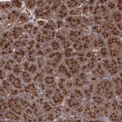 Thyroid receptor-interacting protein 11 Antibody, Novus Biologicals:Antibodies:Primary