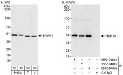 Thyroid receptor-interacting protein 13 Antibody, Novus Biologicals 0.1mg;