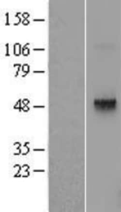 Novus Biologicals&trade;&nbsp;TRHR Overexpression Lysate