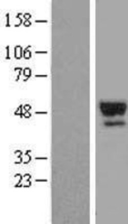 Novus Biologicals&trade;&nbsp;Serpin A7/TBG Overexpression Lysate