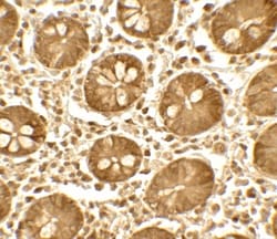 TICRR Antibody - BSA Free, Novus Biologicals:Antibodies:Primary Antibodies