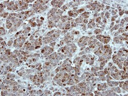 TID1 Antibody, Novus Biologicals 0.1mg; Unlabeled:Antibodies, Polyclonal