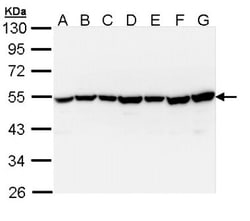 TID1 Antibody, Novus Biologicals 0.1mg; Unlabeled:Antibodies, Polyclonal