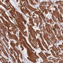 TID1 Antibody, Novus Biologicals 0.1mL; Unlabeled:Antibodies, Polyclonal