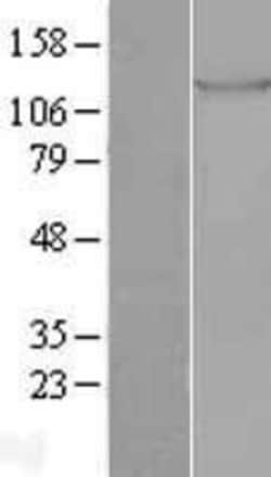 Novus Biologicals&trade;&nbsp;Tie-1 Overexpression Lysate