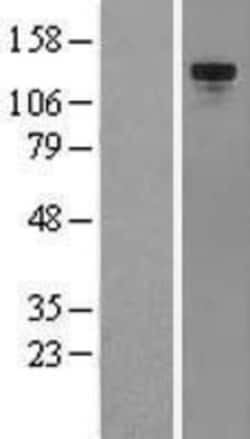 Novus Biologicals™ Tie-2 Overexpression Lysate