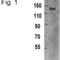 TIF1 gamma Antibody (16G9), Novus Biologicals 0.025 mg | Buy Online | Novus Biologicals | Fisher Scientific