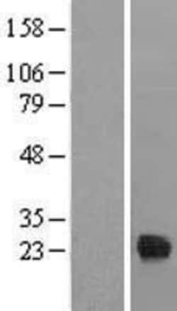Novus Biologicals™ TIFA Overexpression Lysate