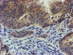 TIGD1 Antibody (OTI4G9), Novus Biologicals 0.1mL; Unlabeled:Antibodies,