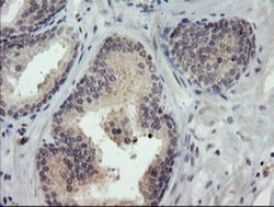 TIGD1 Antibody (OTI4G9), Novus Biologicals 0.1mL; Unlabeled:Antibodies,