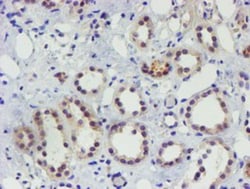 TIGD1 Antibody (OTI4G9), Novus Biologicals 0.1mL; Unlabeled:Antibodies,