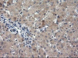 TIGD1 Antibody (OTI4G9), Novus Biologicals 0.1mL; Unlabeled:Antibodies,