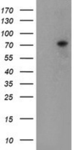 TIGD1 Antibody (OTI4G9), Novus Biologicals 0.1mL; Unlabeled:Antibodies,