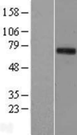 Novus Biologicals™ TIGD1 Overexpression Lysate